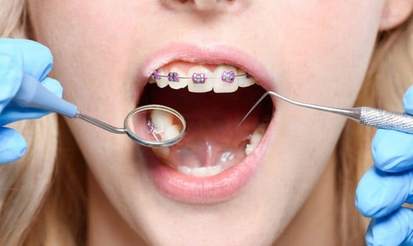 Periodontal Care