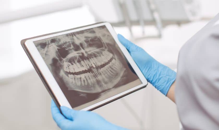 Digital Revolution in Dentistry