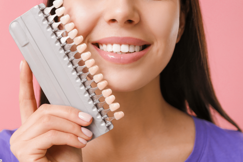 Why Do Veneers Only Last 10 Years?