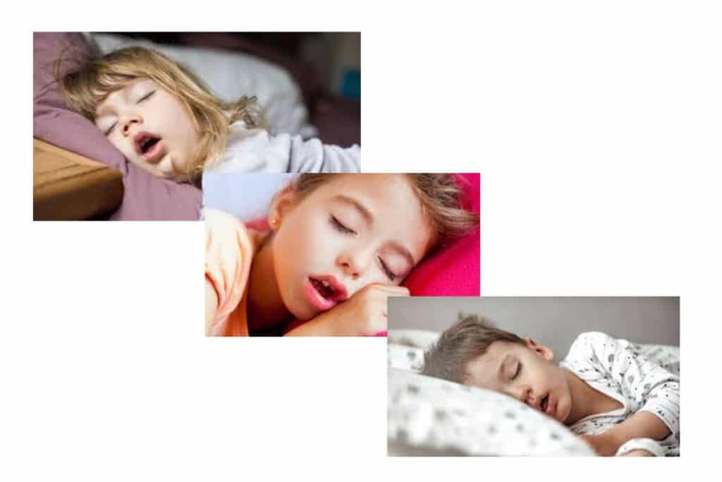 Why is My Child Breathing with His Mouth Open?